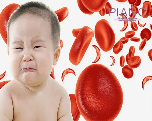 کم خونی کودکان
