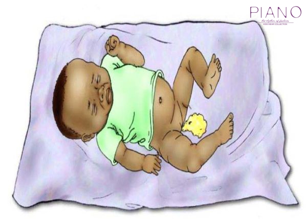 علل اسهال در نوزادان